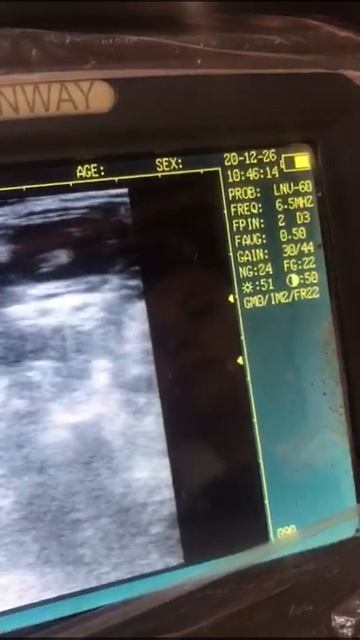 Confirmacion de preñez de perrita pinchers (31 días de gestación) смотреть онлайн