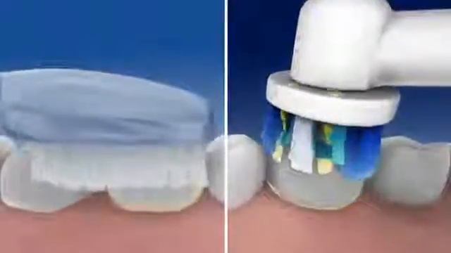 Oral-B 1000 Professional Care 3 смотреть онлайн