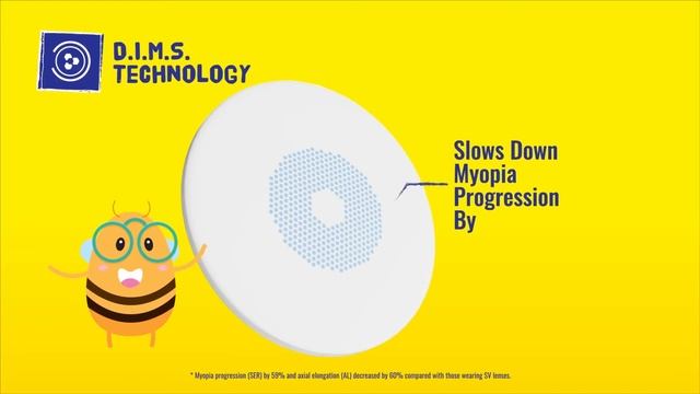 MiyoSMART Myopia Control Lens смотреть онлайн
