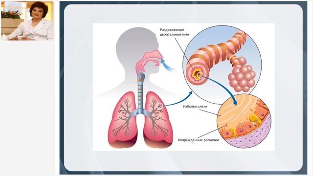Радькова Л.И. «ПРИМЕНЕНИЕ ПРОДУКЦИИ КОМПАНИИ ПРИ БРОНХОЛЁГОЧНЫХ ЗАБОЛЕВАНИЯХ. Ч.1» 8.04.24 смотреть онлайн