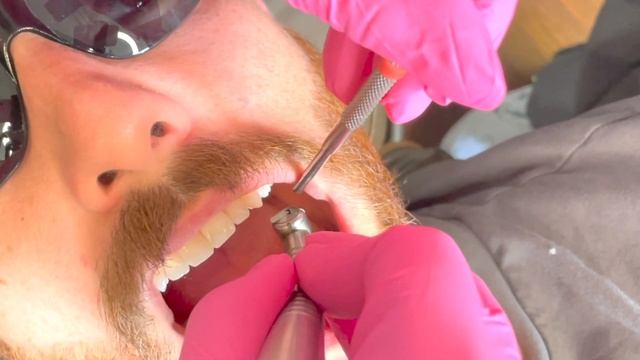 DENTAL SUCTIONING TECHNIQUES // Tips For Dental Assistants смотреть онлайн