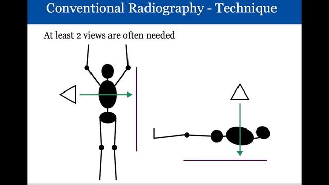 index-2 смотреть онлайн