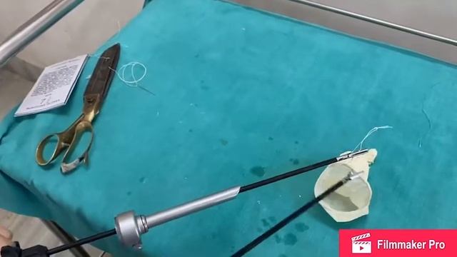 Best endobag using glove, and best technique to launch endobag into peritoneum смотреть онлайн
