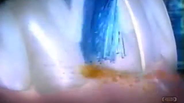 Oral B ProfessionalCare 8000 Series | Television Commercial | 2004 смотреть онлайн