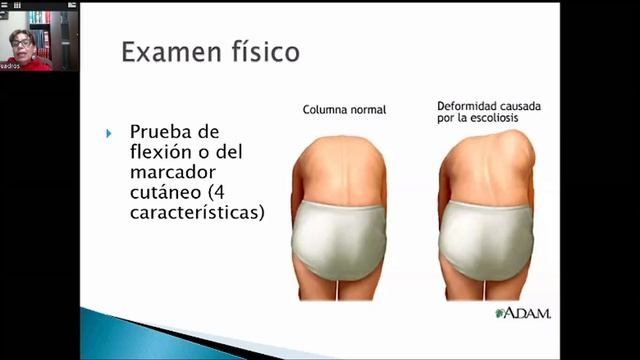 Teorica TEK 400 30-06 TEMA 4 Patologias ostemioarticulares de Columna. смотреть онлайн