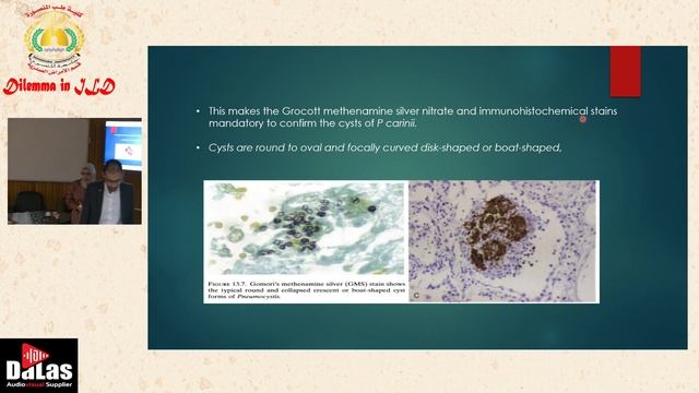 Pneumocystis jirovecii pneumonia (PCP) | Pathology overview смотреть онлайн