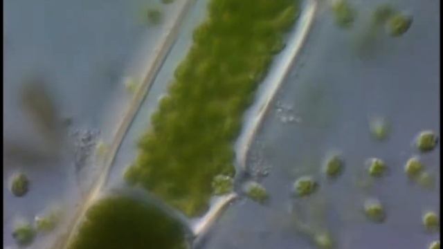 Basicladia Releasing Zoospores