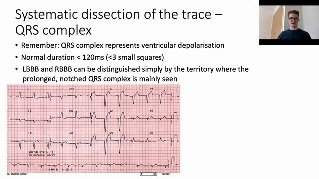 ECG QRS Complex and Bundle Branch Block: The Cambridge Approach смотреть онлайн
