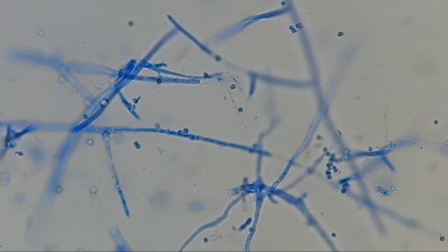 Fungus, Trichoderma growth on SDA, Conidia, phialides and conidiophores in LPCB Preparation смотреть онлайн