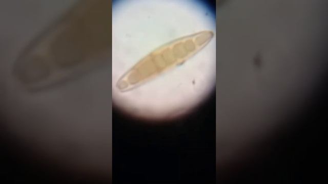 Alternaria under Microscope смотреть онлайн