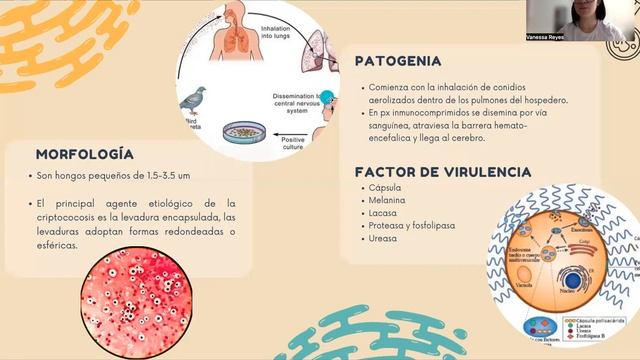 Pia cryptococcus neoformans смотреть онлайн