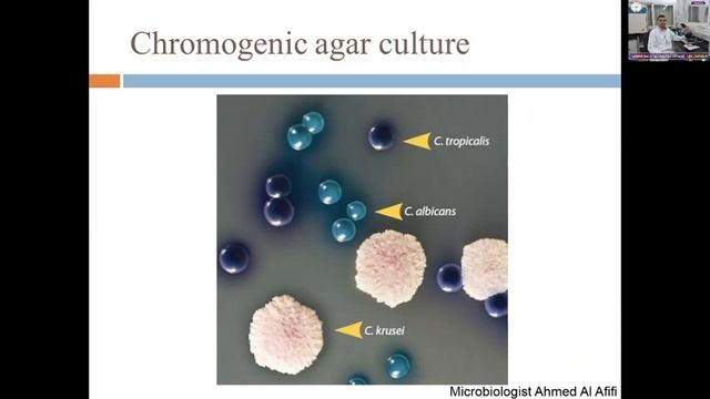 IDENTIFICATION OF CANDIDA SPP