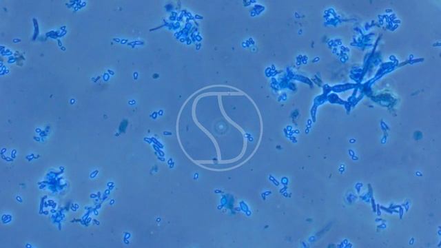 Trichophyton tonsurans with Lactophenol Cotton Blue Stain, Bright Field and Phase Contras Microscop смотреть онлайн