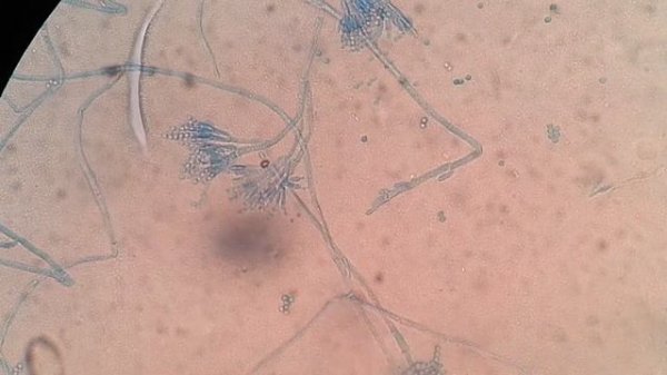 Bacillus cereus selective medium with Penicillium