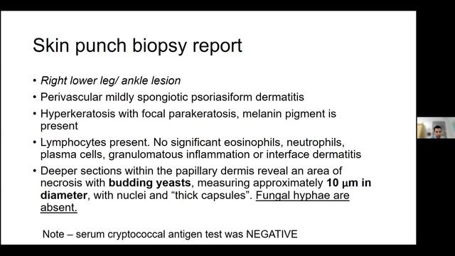 Fungal Infections In Neutropenia - Nelesh Govender