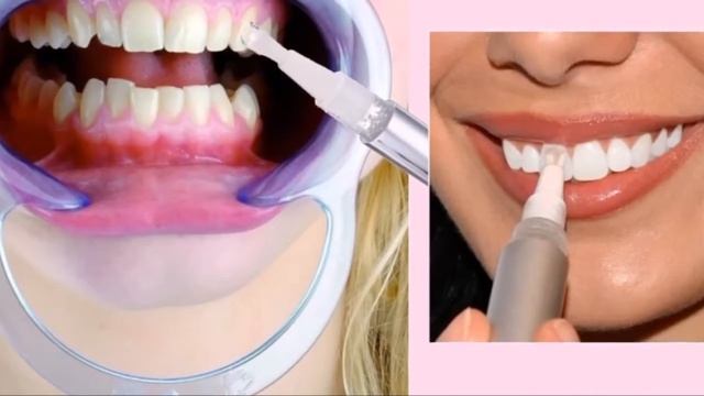 FREE Teeth Whitening Training Course смотреть онлайн