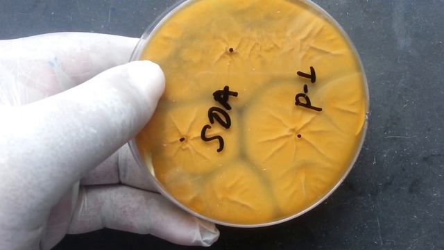 Penicillium Growth On SDA