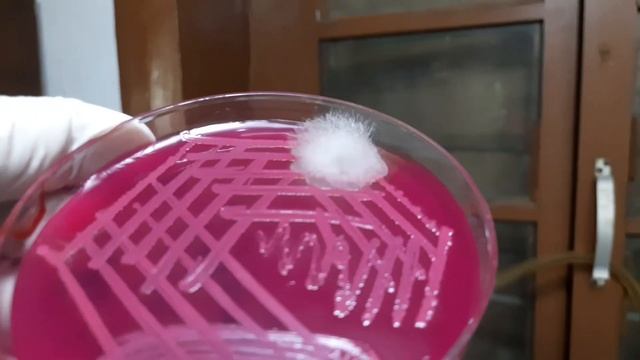 Bacteria and Fungus colony morphology Demonstration смотреть онлайн