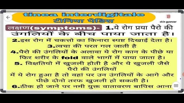 Tinea Interdigitale,ringworm, Dermatophytosis,fungal Infaction Causes,symptoms,treatment.दाद इलाज।