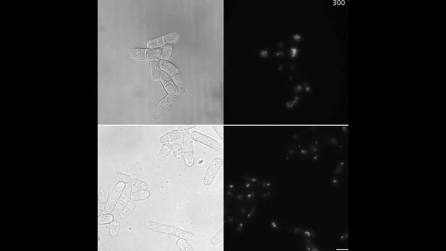 Accumulation And Asymmetric Segregation Of Protein Aggregates After Stress In S.pombe