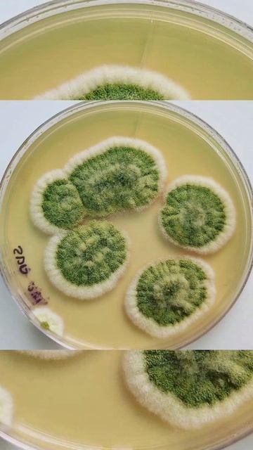 Fungus 😍❤️💙🤍💚. #shorts #shortsfeed #microbiology #microbiologyinsider #microbialinsider