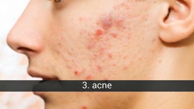 Le Più Comuni Malattie Della Pelle