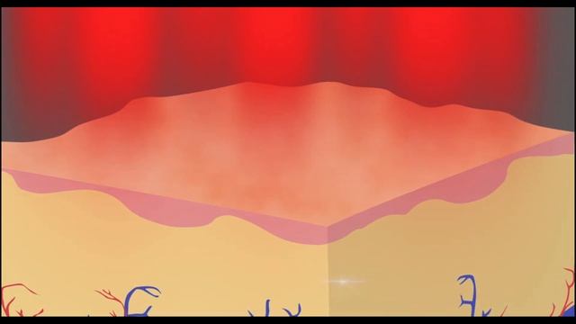 Cynosure PicoSure Fous Lens Array at Body Beautiful Laser Med Spa in Cranberry смотреть онлайн