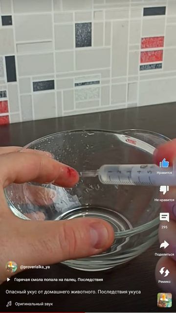 Что делать когда тебя укусил хомяк. Последствия смотреть онлайн