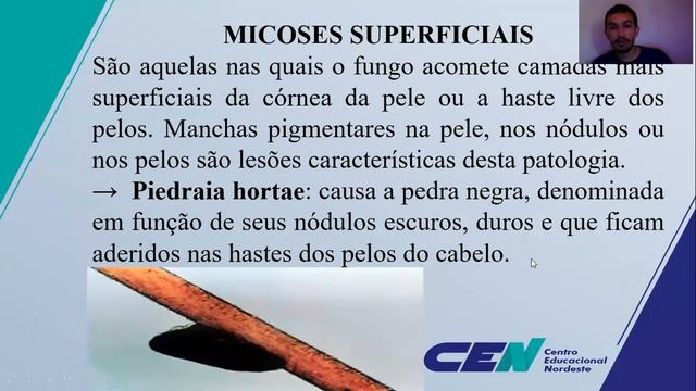 Aula 6 – MICROBIOLOGIA DOS FUNGOS E SUAS ESTRUTURAS смотреть онлайн