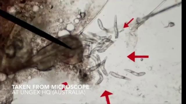 Demodex Lifecycle- Real Microscope смотреть онлайн
