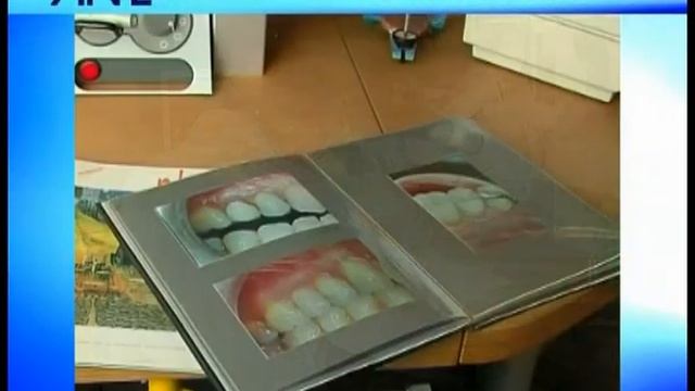 Antlo - Titolari di Laboratorio Odontotecnico смотреть онлайн
