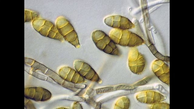 853, 304 Hz : Alternaria Tenuis (RIFE Healing Frequency)