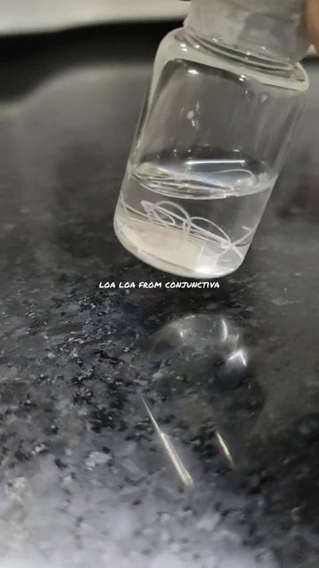 Loa loa (wormworm / eye worm) смотреть онлайн