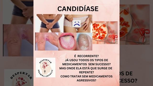CANDIDÍASE 1 смотреть онлайн