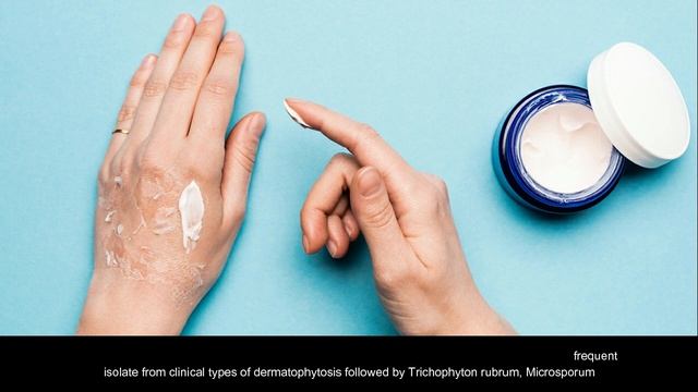 Isolation of Dermatophytes from Superficial Fungal Infections at Badaun, Uttar Pradesh смотреть онлайн