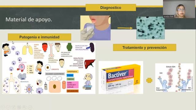PIA: Pneumocystis jirovecii. JOCELYN RODRIGUEZ смотреть онлайн