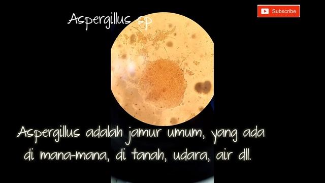 CEK BENTUK JAMUR KURAP, KUKU, RAMBUT, KUMIS, DLL