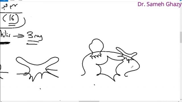 Systemic Pathology 71 : GIT 10 (diseases Of Mouth) Dr. Sameh Ghazy