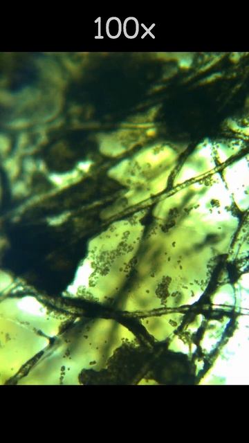 Черная плесень под микроскопом.