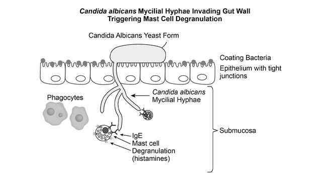 On the Origin of Diseases Video 4 - Candida Albicans смотреть онлайн