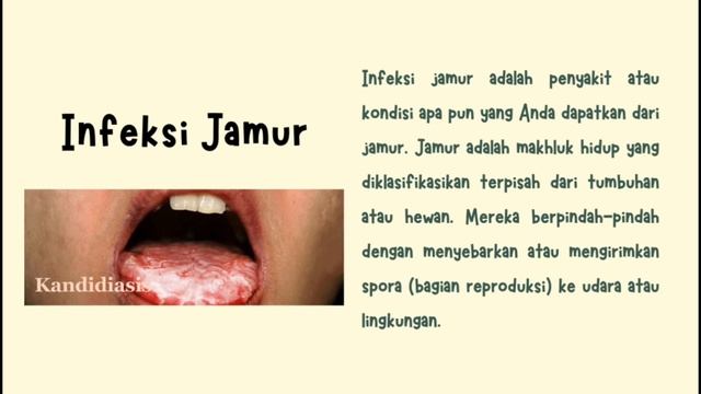 FITOTERAPI DALAM PENGOBATAN PENYAKIT INFEKSI смотреть онлайн