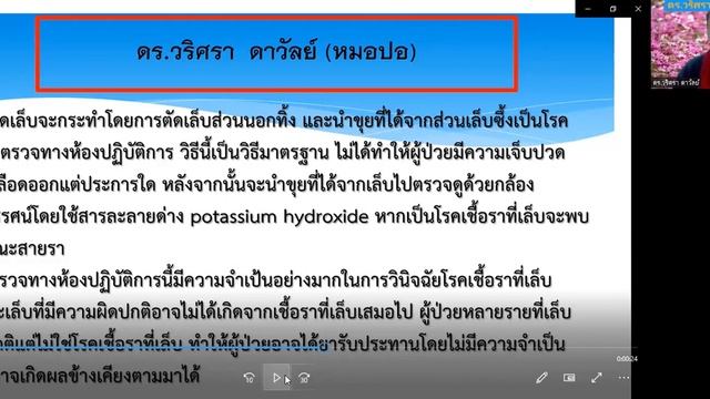 Ep 578 รักษาเชื้อราที่เล็บ ก่อนเล็บผิดรูป ทำให้ไม่สวย смотреть онлайн