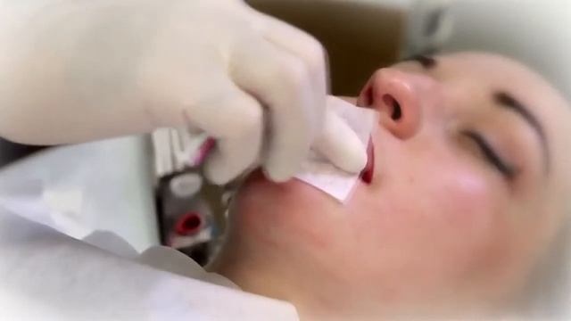 Ранозаживляющая сыворотка Re3Derm смотреть онлайн