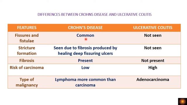 DIFFERENCES BETWEEN CROHNS DISEASE, ULCERATIVE COLITIS AND INVESTIGATIONS IN IBD - By Dr.V.Shanthi