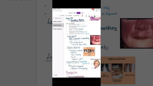 SARCOIDOSIS смотреть онлайн