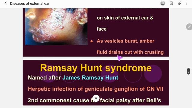 Diseases of the External Ear | Nepali ENT Lecture | part 2 смотреть онлайн