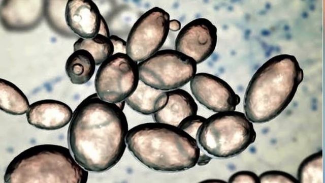 Lavaduras No-Saccharomyces 🦠🧪🧬💊💉 José Ignacio Fombona Valencia смотреть онлайн