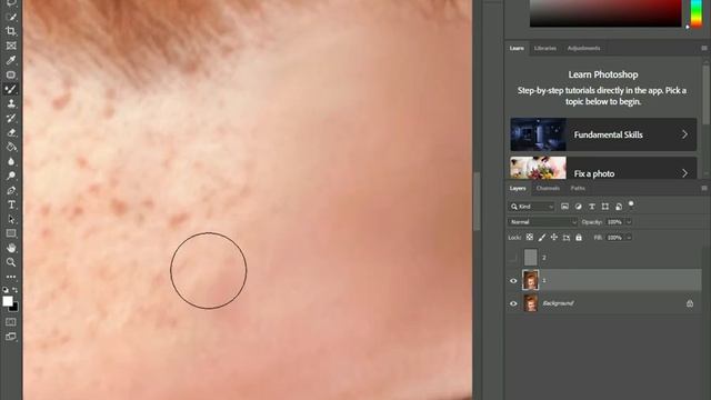 High - End Skin retouching remove pipmple and acne on face | Skin retouching photoshop tutorial. смотреть онлайн