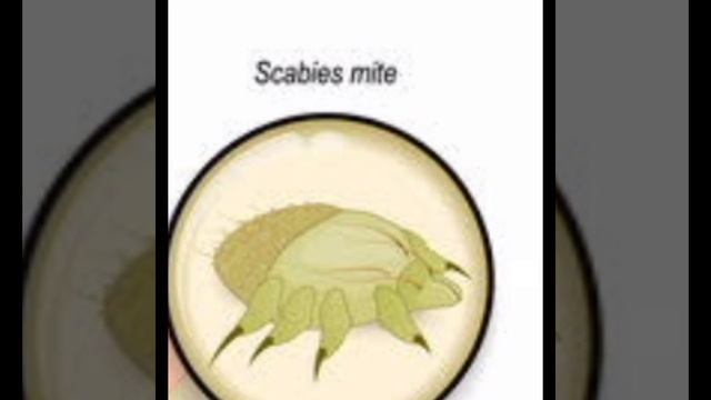 Scabies Mite смотреть онлайн