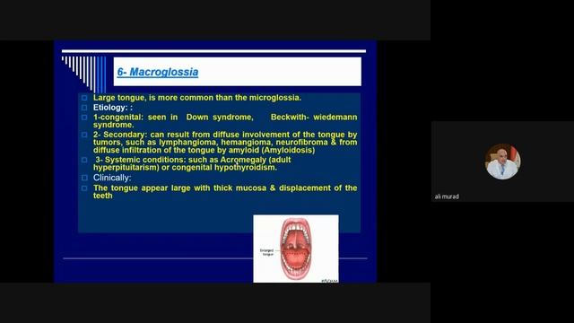 Lec 7 2nd term Oral medicine смотреть онлайн